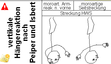 vojta-abornmal